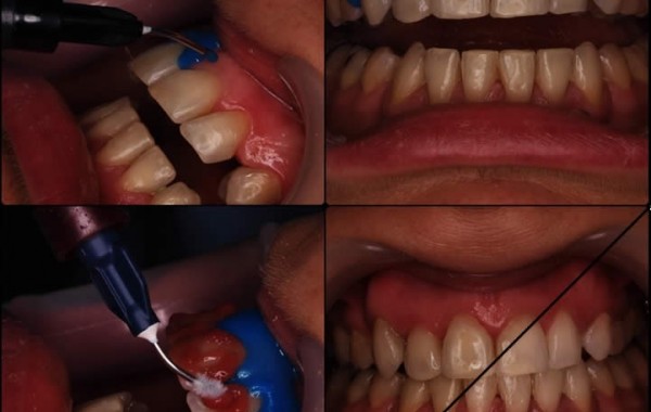 Odontología estética